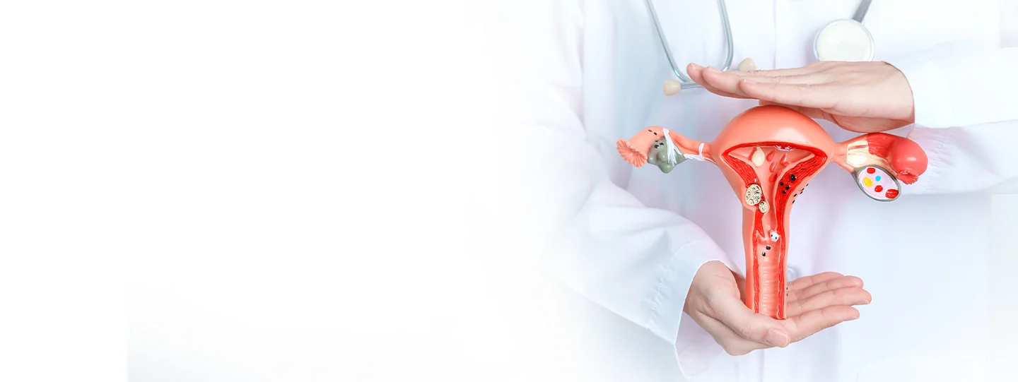 Ovarian Dermoid Cyst Treatment in India: Diagnosis, Surgery & Recovery Explained